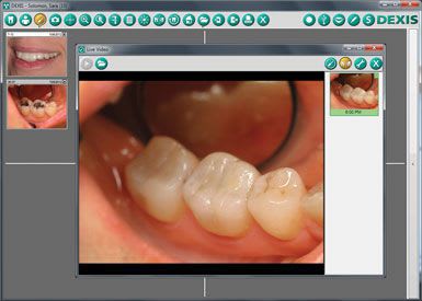 Diagnostic software / treatment plan evaluation / for dental imaging DEXIS DEXIS