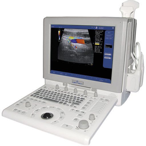 Portable ultrasound system / for multipurpose ultrasound imaging ULTIMA SM Radmir