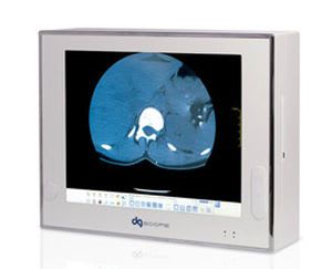 Digital X-ray film viewer / 1-section DGSCOPE