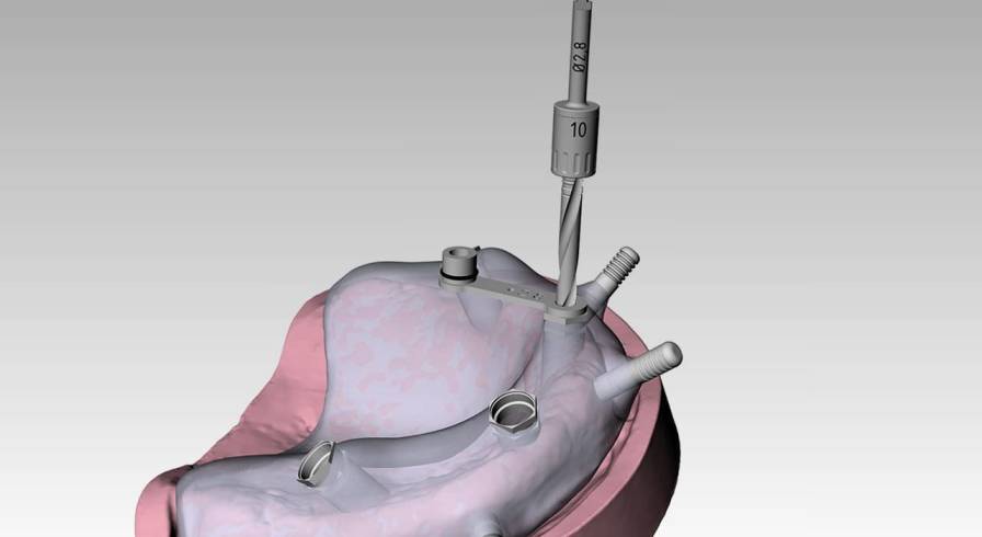 CAD software / CAM / medical / surgery RealGUIDE™ 3DIEMME
