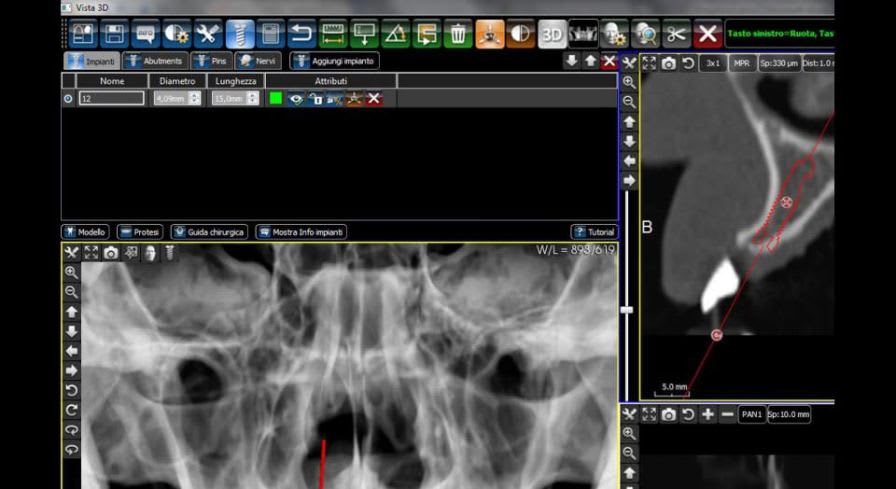 3D simulation software / 3D viewing / diagnostic / medical imaging 3Diagnosys® 3DIEMME