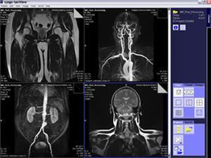 Viewing software / medical / for DICOM files syngo fastView Siemens Healthcare
