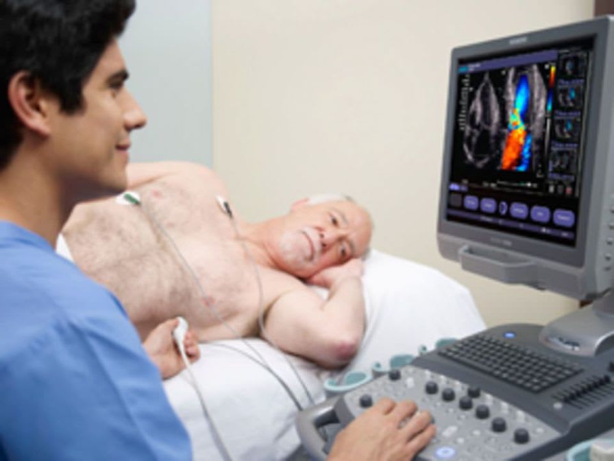 Ultrasound system / on platform / for cardiovascular ultrasound imaging ACUSON X300 PE Siemens Healthcare