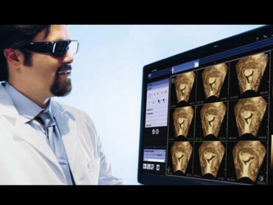 Diagnostic software / viewing / medical imaging / medical syngo®.fourSight™ Siemens Healthcare