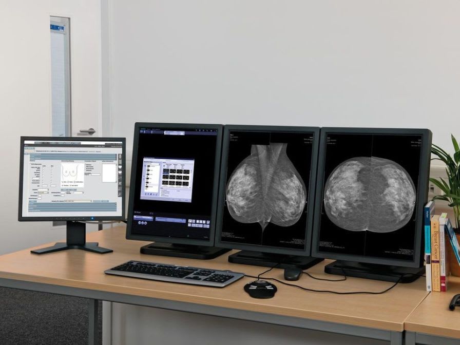 Viewing software / diagnostic / medical / for mammography syngo.Breast Care Siemens Healthcare