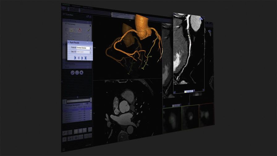 3D viewing software / diagnostic / medical imaging / medical syngo.via Siemens Healthcare