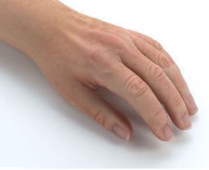 Hand external cosmetic prosthesis RSLSteeper