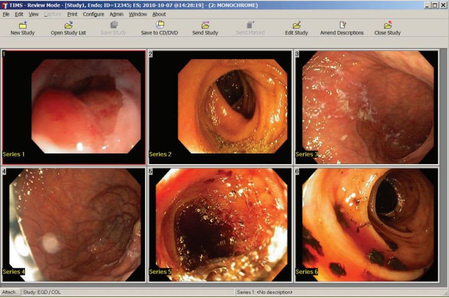 Capture software / viewing / medical / for DICOM files TIMS v2.3 TIMS Medical