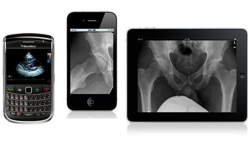 Management iOS application / viewing / medical imaging / medical TIMS Mobile DICOM TIMS Medical