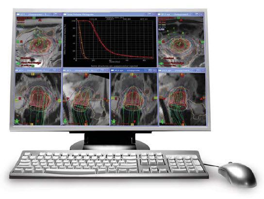 Viewing software / medical / for PACS BrachyVision™ Varian Medical Systems
