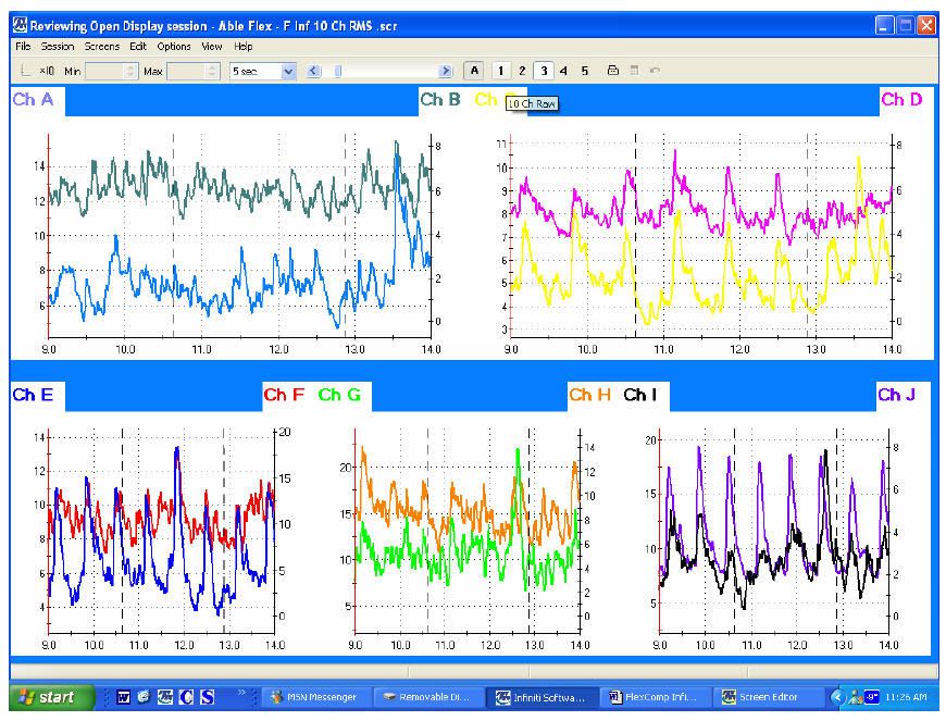 Medical software / electrophysiology DYNAMAP SUITE - SA7925 Thought Technology