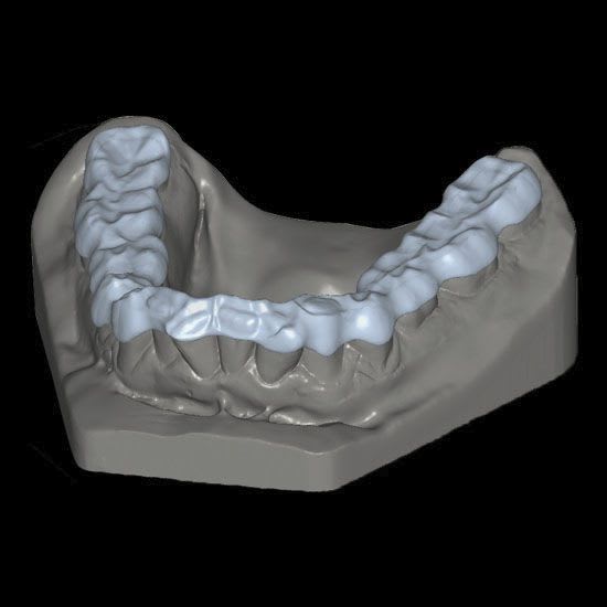 Dental prosthesis design software / CAM / CAD / medical BITE SPLINTS Zirkonzahn
