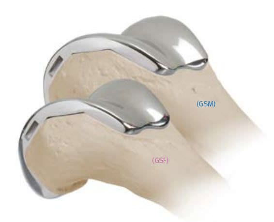 Three-compartment knee prosthesis / traditional / cementless Gender Solutions® Natural-Knee® Flex Zimmer