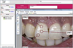 Dental imaging software / medical VITA Assist VITA Zahnfabrik H. Rauter GmbH & Co.KG