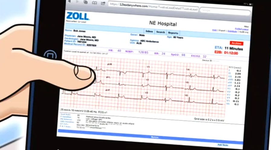 Medical software / data management / electrocardiography RescueNet 12-Lead ZOLL Medical Corporation
