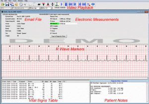 Diagnostic software / ECG ECG Reviewer Vmed Technology