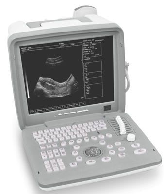 Portable ultrasound system / for gynecological and obstetric ultrasound imaging KJ-603 Xuzhou Kejian Hi-tech