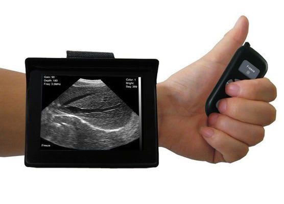 Hand-held veterinary ultrasound system KJ-905 Xuzhou Kejian Hi-tech