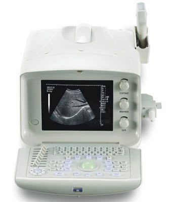 Portable ultrasound system / for multipurpose ultrasound imaging KJ-601 Xuzhou Kejian Hi-tech