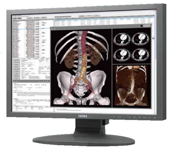 LCD display / high-definition / medical 24.1", 2.3 MP | CCL240 TOTOKU