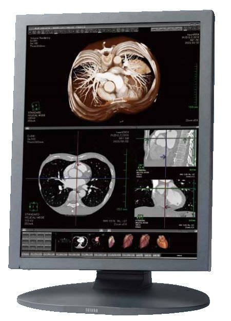 LCD display / medical 20.1", 2 MP | CCL208, CCL208 /AR TOTOKU