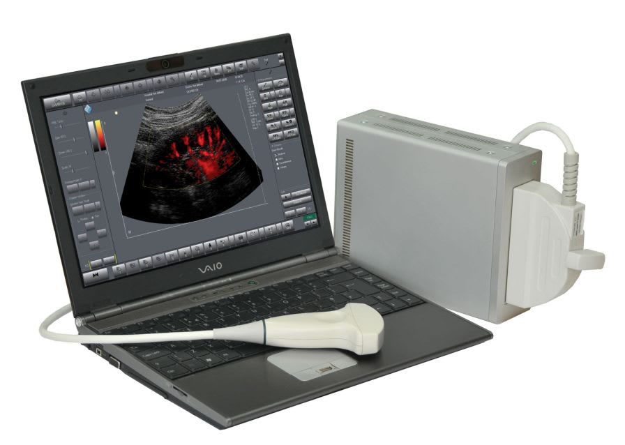 Portable ultrasound system / for multipurpose ultrasound imaging Telemed Medical Systems