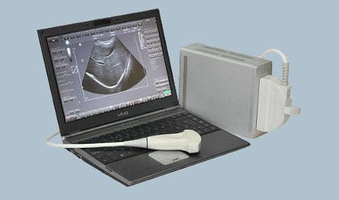 Portable ultrasound system / for abdominal and pelvic ultrasound imaging Telemed Medical Systems