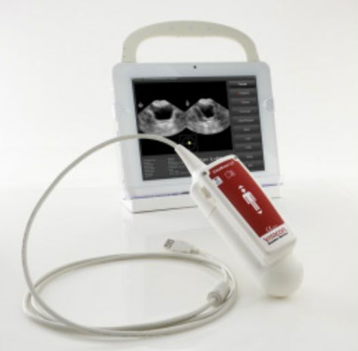 Portable ultrasound bladder scanner VitaScan LT 100525B Vitacon