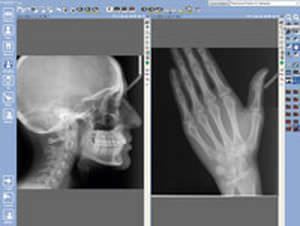 Panoramic X-ray system (dental radiology) / cephalometric X-ray system / digital Planmeca ProMax® / ProCeph™ Planmeca