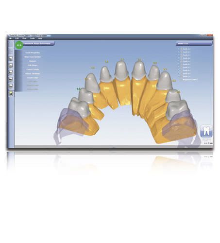 CAM software / for dental prosthesis design / CAD / medical Planmeca PlanCAD® Premium Planmeca