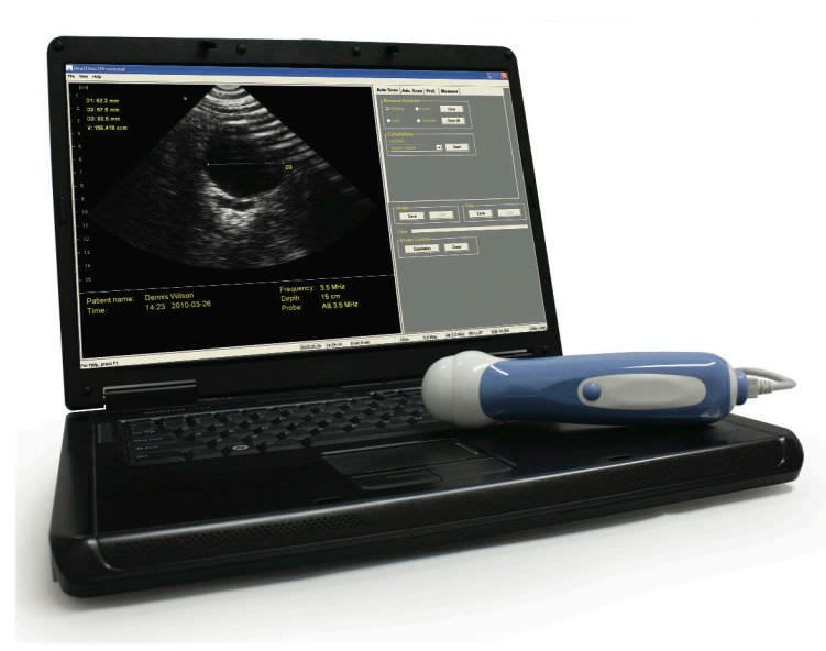 Portable ultrasound system / for urology ultrasound imaging / all-in-one probe HELLO MORPHEUS™ The Prometheus Group