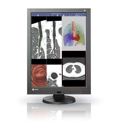 LCD display / high-definition / medical 21.3", 2 MP | RadiForce RX240 EIZO Corporation