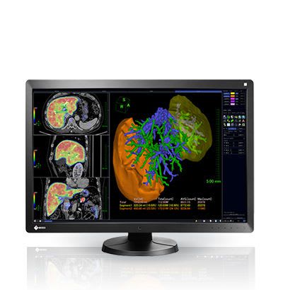 LCD display / high-definition / medical 30", 6 MP | RadiForce RX650 EIZO Corporation