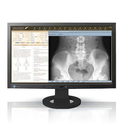 LCD display / medical 23", 2 MP | RadiForce MS230W EIZO Corporation