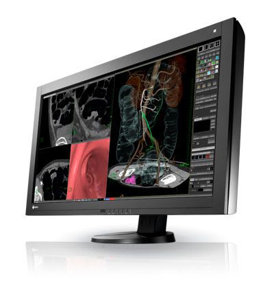 High-definition display / LCD / medical 36.4", 8 MP | RadiForce RX840 EIZO Corporation