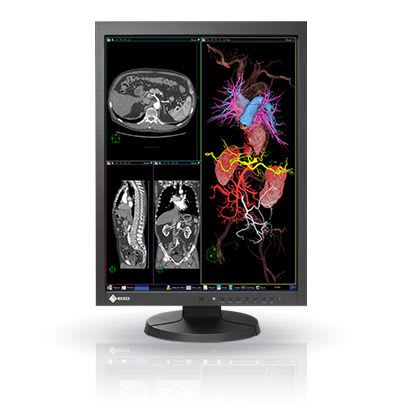 LCD display / high-definition / medical 21.3", 2 MP | RadiForce MX215 EIZO Corporation