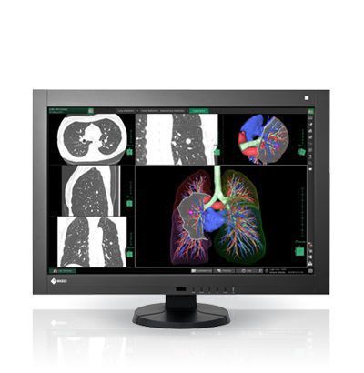 LCD display / high-definition / medical 29.8", 4 MP | RadiForce RX440 EIZO Corporation