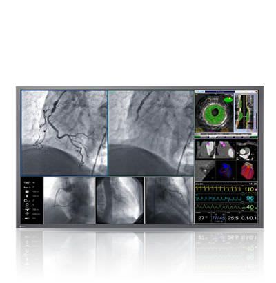 LCD display / high-definition / surgical 60.1", 8 MP | RadiForce LX600W EIZO Corporation
