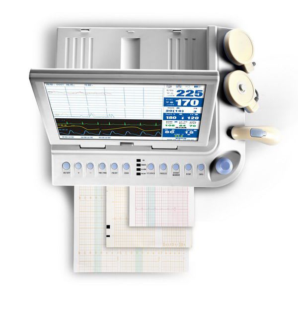 Fetal and maternal monitor 12.1" TFT | SM-100 Sonostar Technologies