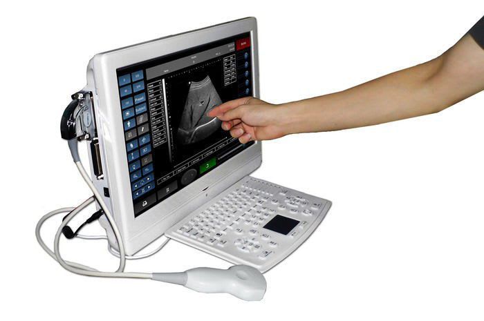 Portable ultrasound system / for multipurpose ultrasound imaging / touchscreen / built-in console 18" | UTouch-8 Sonostar Technologies