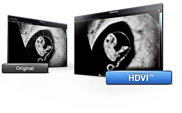 Ultrasound system / on platform / for multipurpose ultrasound imaging Accuvix XG Samsung Medison