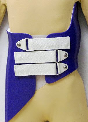 Thoracolumbosacral (TLSO) support corset / scoliosis Providence Nocturnal Spinal Technology