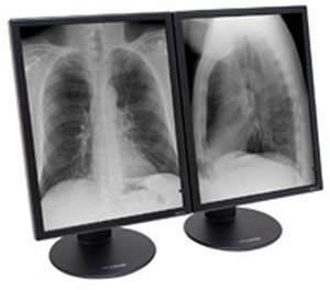 Monochrome display / medical 21.3", 3 MP | Dome S3 NDS Surgical Imaging