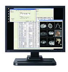 High-definition display / LCD / medical 20.1", 2 MP | Dome GX2MP Plus NDS Surgical Imaging