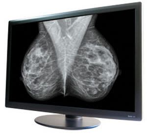 Monochrome display / medical 30", 10 MP | Dome S10 NDS Surgical Imaging
