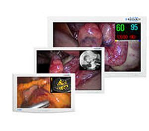 LCD display / high-definition / surgical 19 - 42 " | Radiance® Full MMI NDS Surgical Imaging
