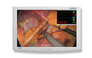 High-definition display / LED / surgical 24" | Radiance® G2 NDS Surgical Imaging