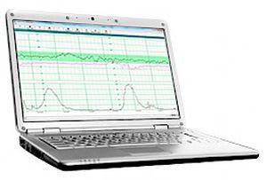 Analysis software / medical / EMR Fetal2EMR™ Wallach Surgical Devices