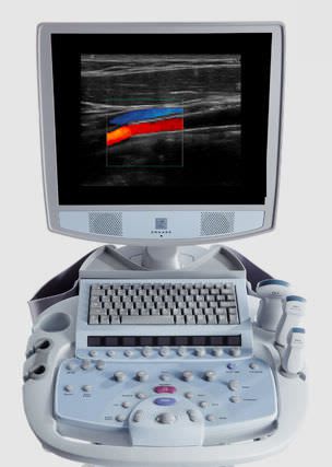 Ultrasound system / on platform, compact / for emergency medecine ultrasound imaging z.one ultra sp ZONARE Medical Systems