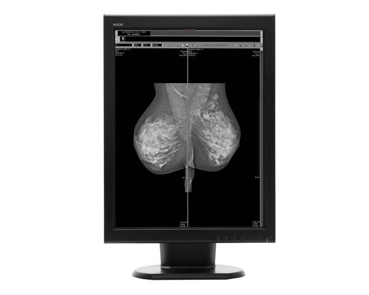 LCD display / monochrome / medical 21.3", 5 MP | MX50p WIDE Europe